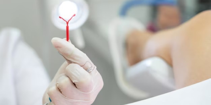 Governo de Goiás realiza mutirão de DIU para ampliar acesso ao planejamento reprodutivo